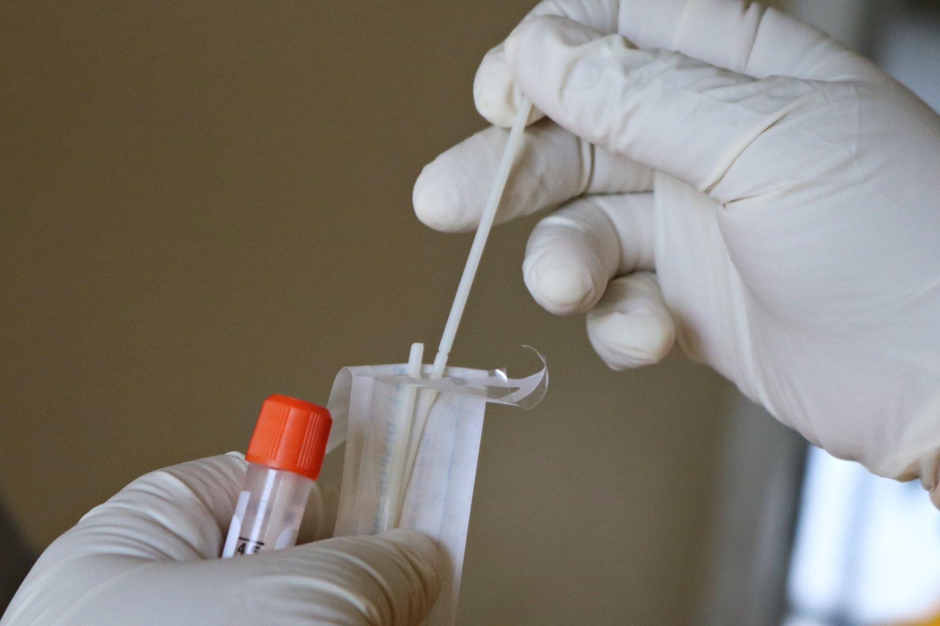 Σκέρτσος: Σε φάση εξομάλυνσης οι επιπτώσεις της πανδημίας χάρη σε εμβόλια και τεστ
